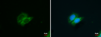Anti-GALK1 antibody used in Immunocytochemistry/ Immunofluorescence (ICC/IF). GTX108990