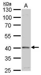 Anti-GALK1 antibody used in Western Blot (WB). GTX108990