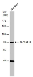 Anti-SLC25A13 antibody [N3C2], Internal used in Western Blot (WB). GTX109001