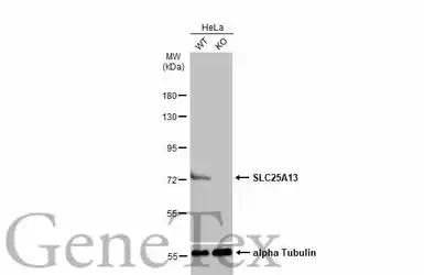 Anti-SLC25A13 antibody [N3C2], Internal used in Western Blot (WB). GTX109001
