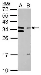 Anti-TFIIE beta antibody used in Western Blot (WB). GTX109005