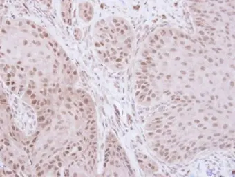Anti-TFIIE beta antibody used in IHC (Paraffin sections) (IHC-P). GTX109005