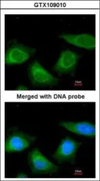 Anti-Thyroxine Binding Globulin antibody used in Immunocytochemistry/ Immunofluorescence (ICC/IF). GTX109010