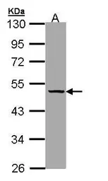 Anti-Thyroxine Binding Globulin antibody used in Western Blot (WB). GTX109010