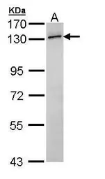 Anti-RNF20 antibody [N2C1], Internal used in Western Blot (WB). GTX109026