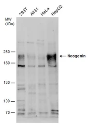 Anti-Neogenin antibody [N1N2], N-term used in Western Blot (WB). GTX109043