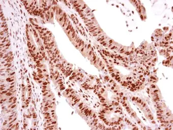 Anti-p73 antibody [N1C1] used in IHC (Paraffin sections) (IHC-P). GTX109045