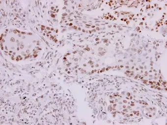 Anti-p73 antibody [N1C1] used in IHC (Paraffin sections) (IHC-P). GTX109045