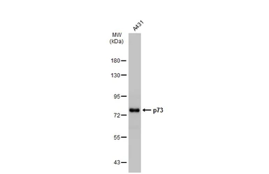 Anti-p73 antibody [N1C1] used in Western Blot (WB). GTX109045