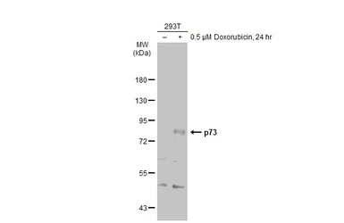 Anti-p73 antibody [N1C1] used in Western Blot (WB). GTX109045