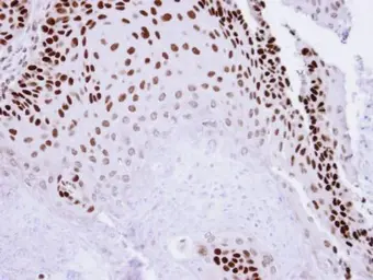 Anti-p73 antibody [N1C1] used in IHC (Paraffin sections) (IHC-P). GTX109045