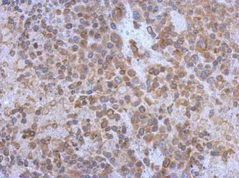 Anti-CD130 antibody used in IHC (Paraffin sections) (IHC-P). GTX109048