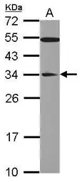 Anti-GAS41 antibody [N1C3] used in Western Blot (WB). GTX109088