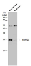 Anti-SNAP23 antibody used in Western Blot (WB). GTX109089
