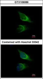 Anti-SNAP23 antibody used in Immunocytochemistry/ Immunofluorescence (ICC/IF). GTX109089