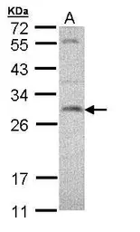 Anti-SNAP23 antibody used in Western Blot (WB). GTX109089