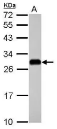 Anti-ETHE1 antibody used in Western Blot (WB). GTX109095