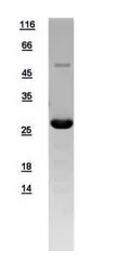 Human RALB protein, His tag. GTX109101-pro