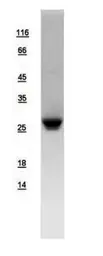 Human NNT1 protein, His tag. GTX109107-pro