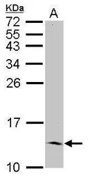 Anti-ID2 antibody [N1C3] used in Western Blot (WB). GTX109113