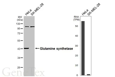 Anti-Glutamine synthetase antibody used in Western Blot (WB). GTX109121
