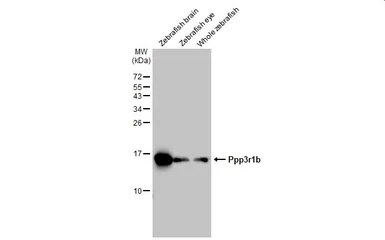 Anti-Calcineurin B antibody used in Western Blot (WB). GTX109127
