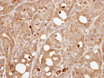 Anti-Calcineurin B antibody used in IHC (Paraffin sections) (IHC-P). GTX109127