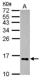 Anti-Galectin 2 antibody used in Western Blot (WB). GTX109135