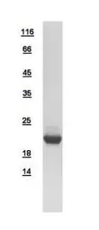 Human DUSP3 protein, His tag. GTX109149-pro