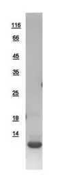 Human S100A4 protein, His tag. GTX109153-pro