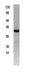 Human BCL10 protein, His tag. GTX109159-pro