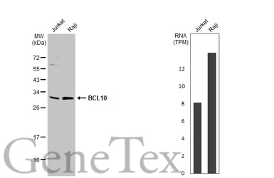 Anti-BCL10 antibody [N1C3] used in Western Blot (WB). GTX109159