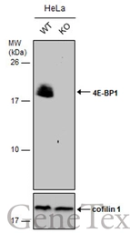 Anti-4E-BP1 antibody [N1C3] used in Western Blot (WB). GTX109162