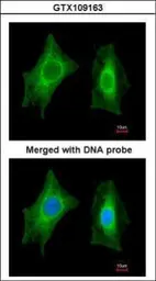 Anti-PSPH antibody used in Immunocytochemistry/ Immunofluorescence (ICC/IF). GTX109163