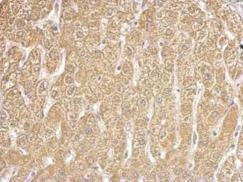 Anti-HIBCH antibody used in IHC (Paraffin sections) (IHC-P). GTX109167