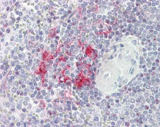 Anti-LITAF antibody [N1C3] used in IHC (Paraffin sections) (IHC-P). GTX109173