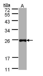 Anti-LITAF antibody [N1C3] used in Western Blot (WB). GTX109173