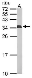 Anti-ETFB antibody [N1C3] used in Western Blot (WB). GTX109189