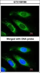 Anti-ETFB antibody [N1C3] used in Immunocytochemistry/ Immunofluorescence (ICC/IF). GTX109189