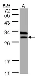 Anti-ETFB antibody [N1C3] used in Western Blot (WB). GTX109189