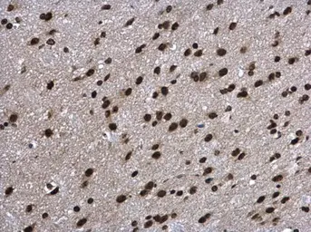 Anti-Aprataxin antibody used in IHC (Paraffin sections) (IHC-P). GTX109196