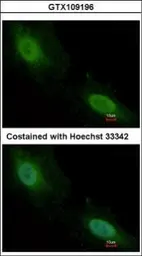 Anti-Aprataxin antibody used in Immunocytochemistry/ Immunofluorescence (ICC/IF). GTX109196