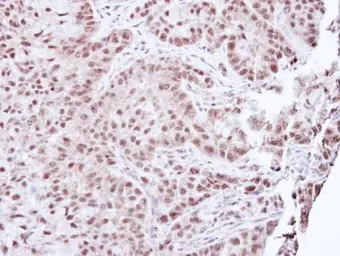 Anti-Aprataxin antibody used in IHC (Paraffin sections) (IHC-P). GTX109196