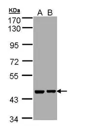 Anti-Aprataxin antibody used in Western Blot (WB). GTX109196