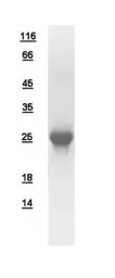 Human Beta A3 Crystallin protein, His tag. GTX109207-pro