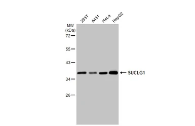 Anti-SUCLG1 antibody used in Western Blot (WB). GTX109215