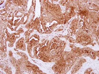 Anti-NPC2 antibody [N1C3] used in IHC (Paraffin sections) (IHC-P). GTX109217