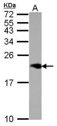 Anti-NPC2 antibody [N1C3] used in Western Blot (WB). GTX109217