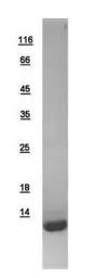 Human PCBD1 protein, His tag. GTX109239-pro