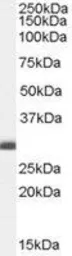 Anti-BCAP31 antibody, C-term used in Western Blot (WB). GTX10924